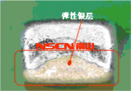 使用柔性端頭降低陶瓷貼片電容短路風(fēng)險